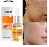 قیمت سرم ویتامین سی لانبنا روشن کننده و ضد لکی اورجینال
