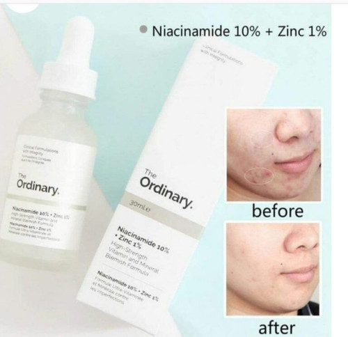 سرم ضدجوش نیاسینامید 10% + زینک ۱ درصد اوردینری اورجینال