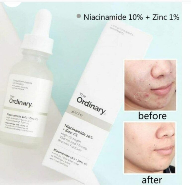 سرم ضدجوش نیاسینامید 10% + زینک ۱ درصد اوردینری اورجینال