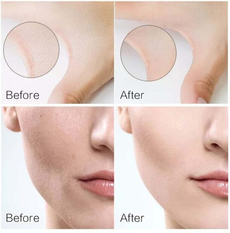 قیمت پرایمر صورت لاکچری اوریفلیم
