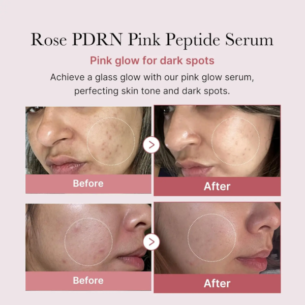 خرید آنلاین سرم روشن کننده پپتاید و PDRN مدی کیوب Medicube حجم 30ml