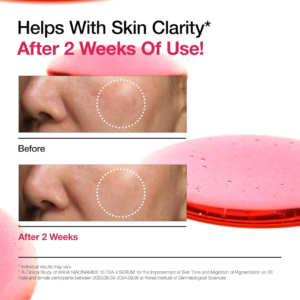 خرید سرم نیاسینامید آنوا | ضد لک و روشن کننده