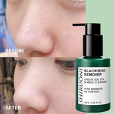 ماسک حبابی جوش سرسیاه سام بای می120گرمی